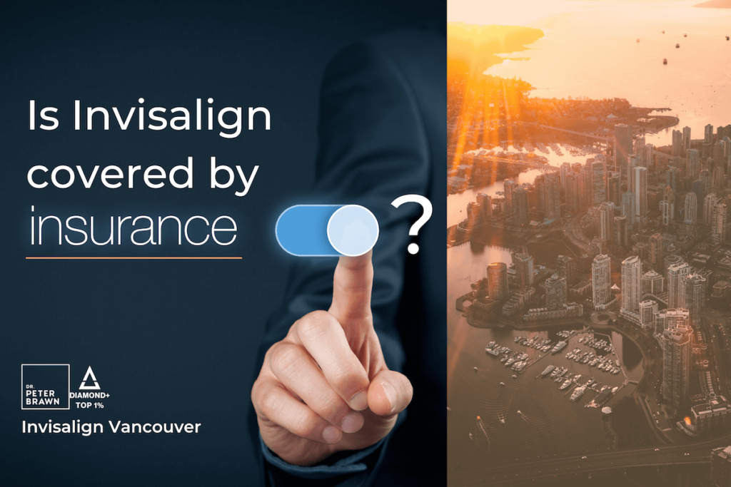 Is Invisalign covered by insurance? - title with photo of Vancouver