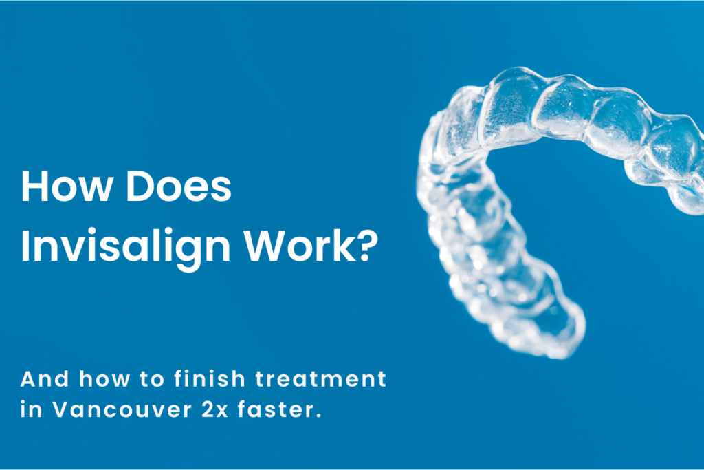 How Does Invisalign Work title graphic with close-up of Invisalign Aligners