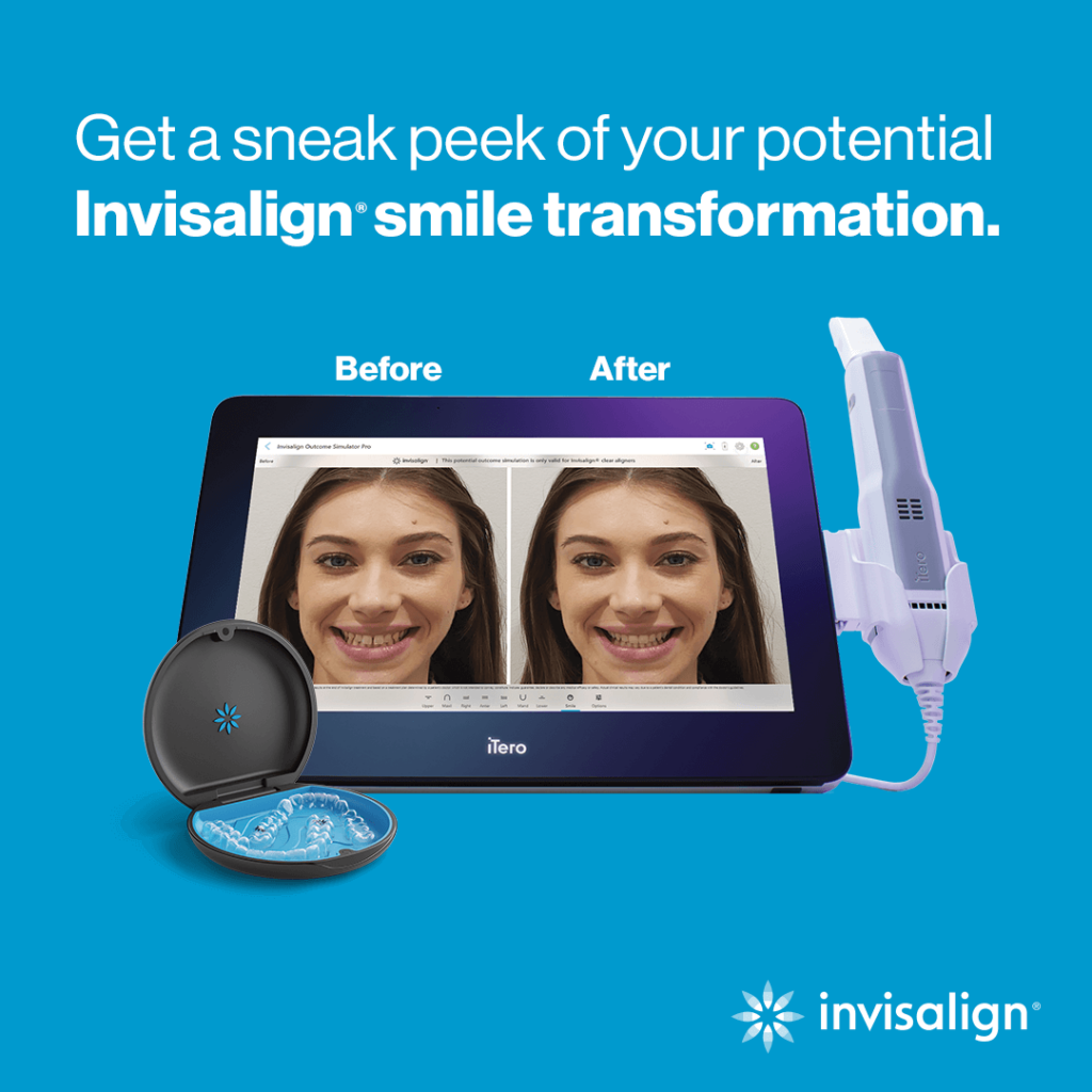 iTero Digital Scanner used by Invisalign dentist to show customized treatment process